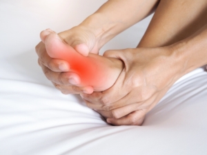 How to Get Rid of Gout Tophi: Is Pegloticase the Answer?
