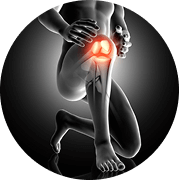 Osteoarthritis