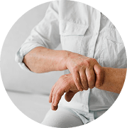 Rheumatoid Arthritis
